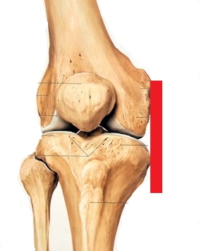 変形性膝関節症について かとう整形外科スポーツ運動器クリニック